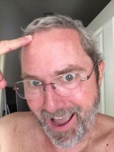 My hair regrowing at the end of March. Coming back mostly white and might just be curly