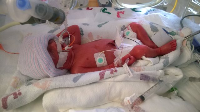 13225023_10208259591441206_398416994_o