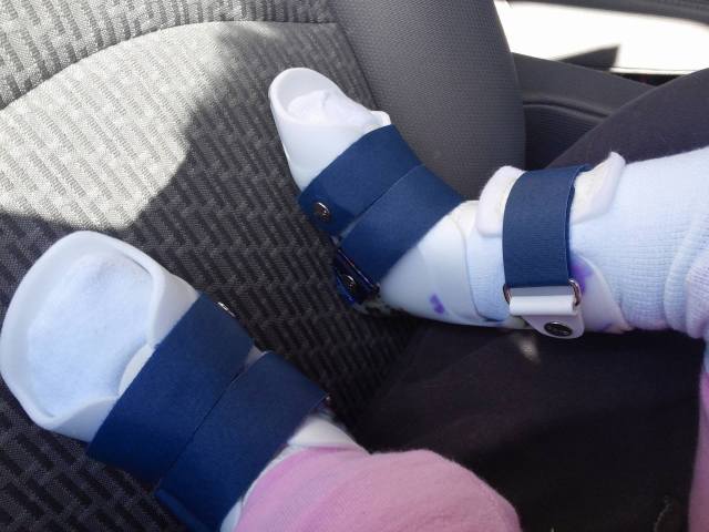 13230859_10208259558560384_2119654354_o